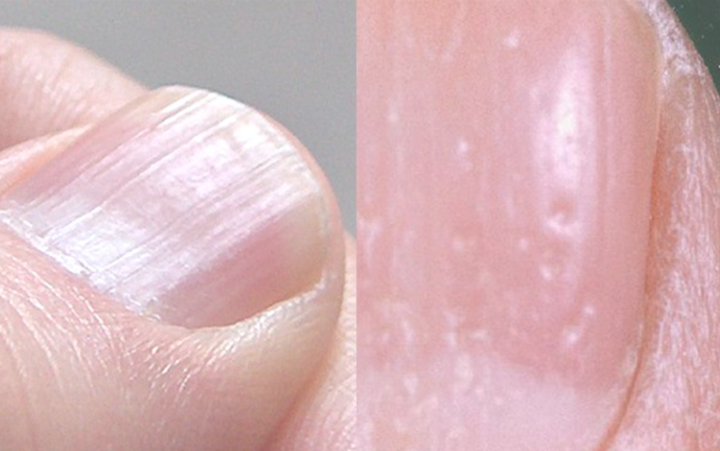 4 triệu chứng cảnh báo mức độc tố trong gan quá cao: Nên sớm thải độc bảo vệ gan - 2