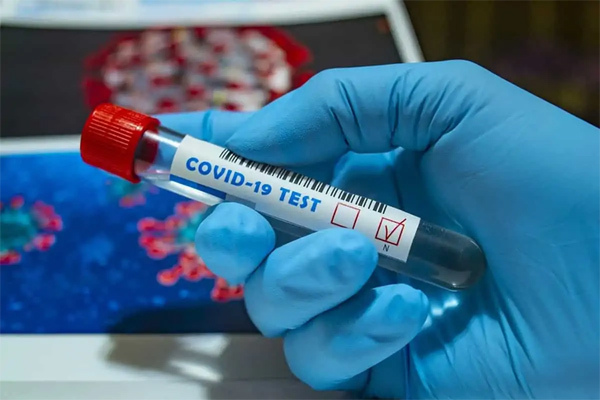 Các đột biến của Omicron sẽ tiêu diệt lẫn nhau? - 1