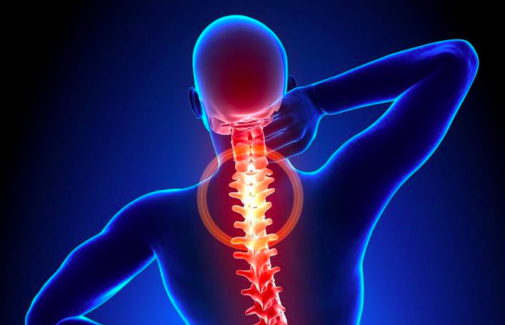 Có 4 trong 9 triệu chứng này thì bạn đã bị bệnh thoái hóa đốt sống cổ 'gọi tên' - 3
