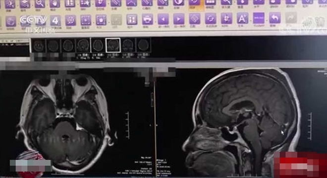 Người phụ nữ co giật, hôn mê sau khi ăn cơm rang để tủ lạnh - 1