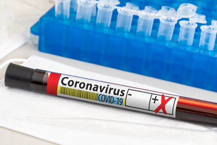 Bằng chứng Omicron gây tái nhiễm cao hơn các biến thể khác - 1