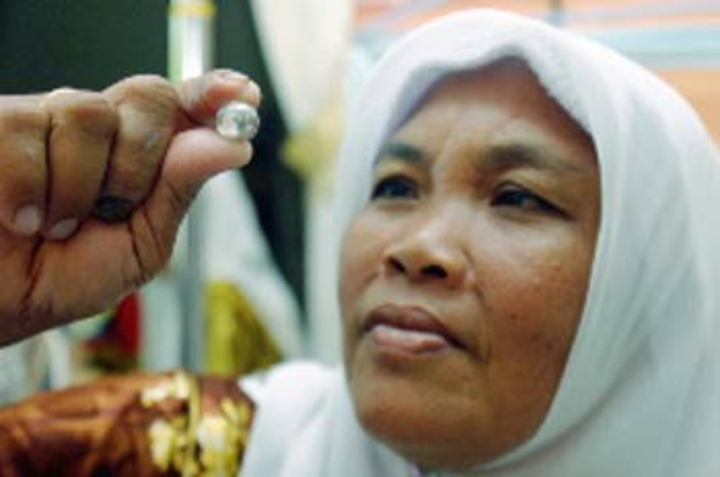 Cô gái có ngón chân ‘nhả ngọc’, bộ sưu tập ‘đá quý’ được mua lại để nghiên cứu - 3