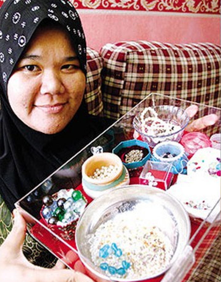 Cô gái có ngón chân ‘nhả ngọc’, bộ sưu tập ‘đá quý’ được mua lại để nghiên cứu - 4