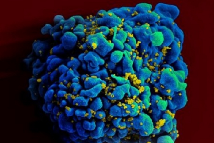 Thử nghiệm thành công vaccine HIV trên động vật - 1