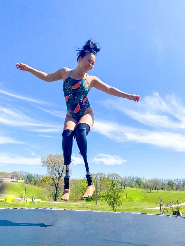 Mất 2 chân sau bi kịch gia đình, 10x gốc Việt vẫn trở thành VĐV vô địch thế giới - 4