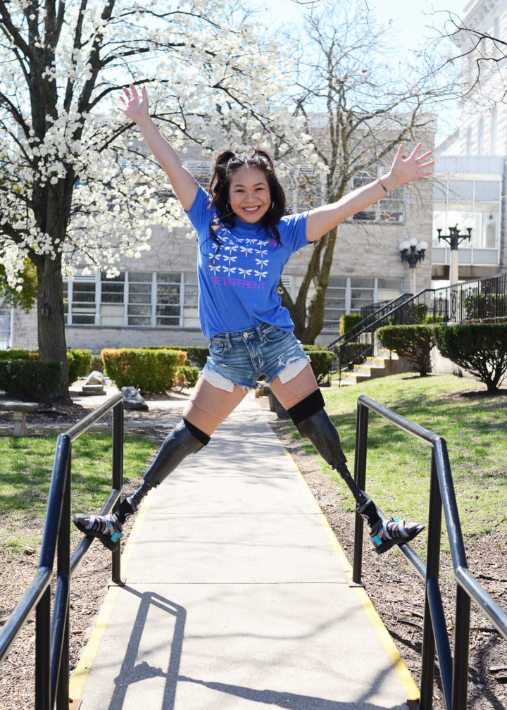 Mất 2 chân sau bi kịch gia đình, 10x gốc Việt vẫn trở thành VĐV vô địch thế giới - 5