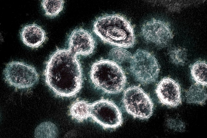 Cơ thể người không chỉ tiêu diệt SARS-CoV-2 bằng kháng thể - 1