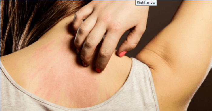 10 dấu hiệu sớm cảnh báo bệnh thận: Đi khám ngay khi thấy triệu chứng đầu tiên - 4