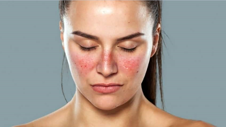 9 căn bệnh gây 'rắc rối' đều có biểu hiện là đau khớp: Cần đi khám để xử lý sớm - 5