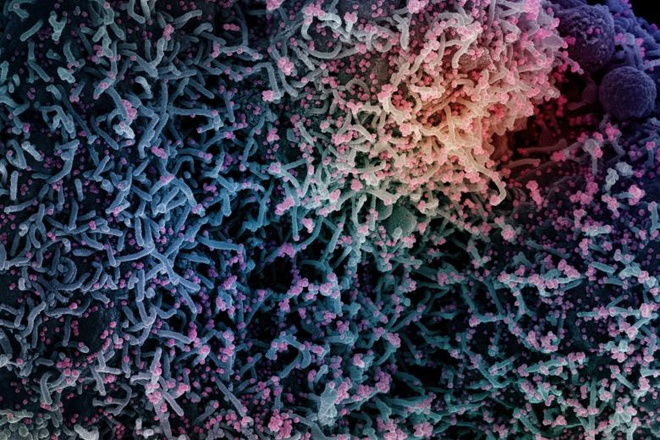 Phát hiện mới về nguyên nhân hiện tượng COVID-19 kéo dài - 1