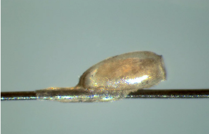 Virus gần 2.000 năm tuổi ẩn mình trong xác ướp cổ đại - 2