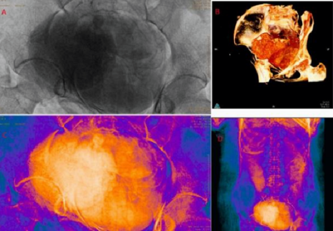 Kỳ lạ bào thai 'phát triển' trong bụng xác ướp 2.000 năm tuổi - 1