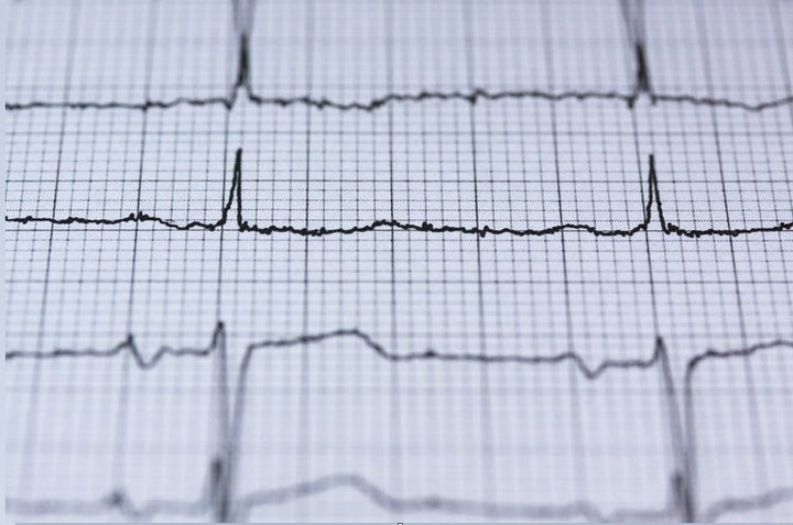 3 loại thực phẩm như 'thần dược' giúp đả thông động mạch, ngăn ngừa máu đông - 2