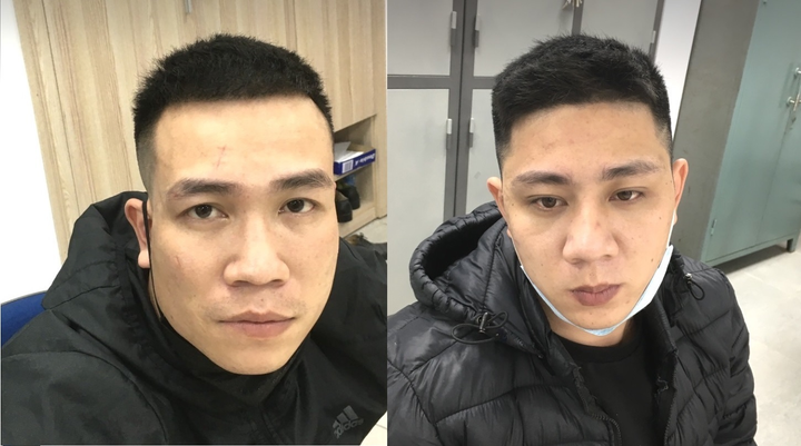 Bắt nhóm thanh niên thuê nhà nghỉ ở phố cổ Hà Nội để 'bay lắc' - 1