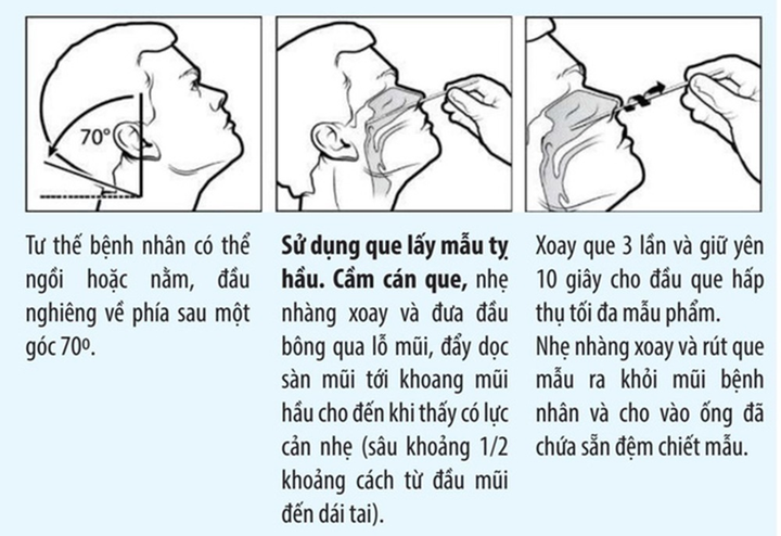 7 bước tự test nhanh COVID-19 tại nhà - 1