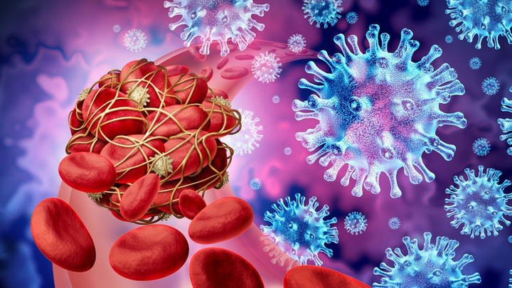 Phát hiện mới về triệu chứng COVID-19 kéo dài - 2