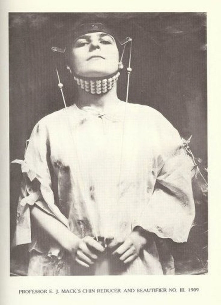 Rùng mình nhìn lại các phương pháp thẩm mỹ không khác gì tra tấn của thời trước - 9