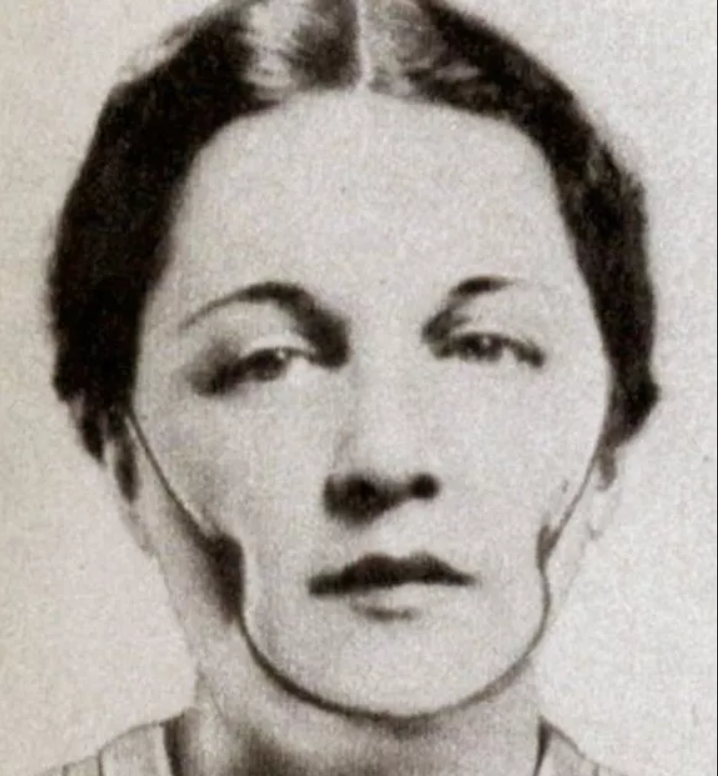 Rùng mình nhìn lại các phương pháp thẩm mỹ không khác gì tra tấn của thời trước - 7