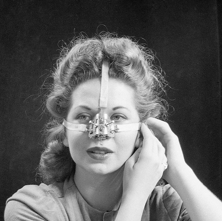 Rùng mình nhìn lại các phương pháp thẩm mỹ không khác gì tra tấn của thời trước - 4