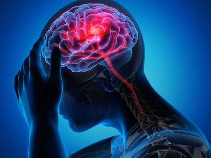 50% số ca ung thư tử vong vì phát hiện 'quá muộn': 10 dấu hiệu không nên bỏ qua - 3