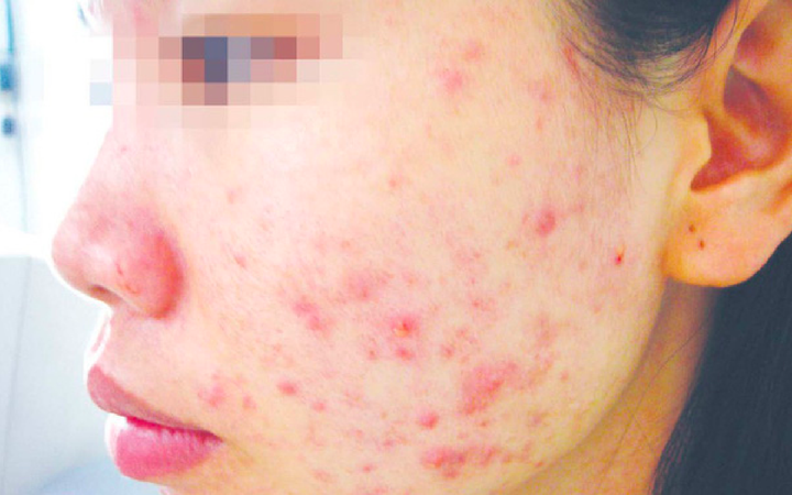 ‘Mê hồn trận’ mỹ phẩm giá rẻ trôi nổi tại nhiều chợ vùng quê - 2