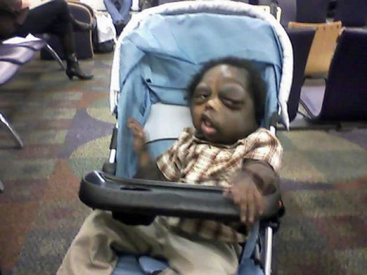 Xót xa hình ảnh hiện tại của cậu bé mang ‘gương mặt quỷ’ gây xôn xao 5 năm trước - 1