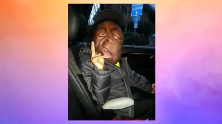 Xót xa hình ảnh hiện tại của cậu bé mang ‘gương mặt quỷ’ gây xôn xao 5 năm trước - 3