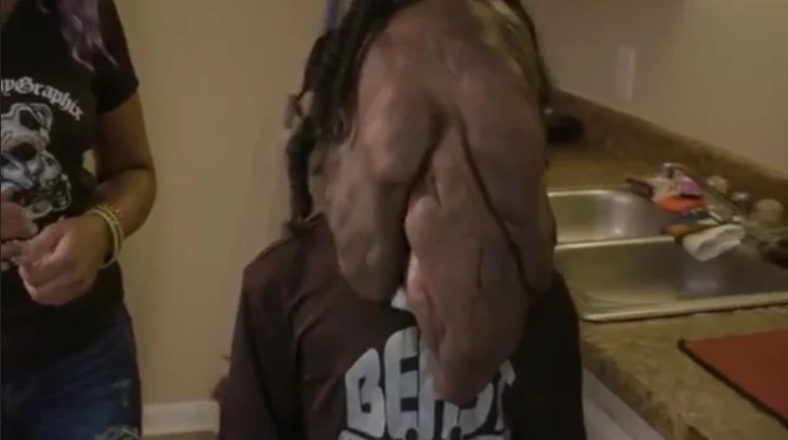 Xót xa hình ảnh hiện tại của cậu bé mang ‘gương mặt quỷ’ gây xôn xao 5 năm trước - 4