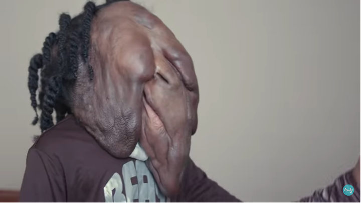 Xót xa hình ảnh hiện tại của cậu bé mang ‘gương mặt quỷ’ gây xôn xao 5 năm trước - 6