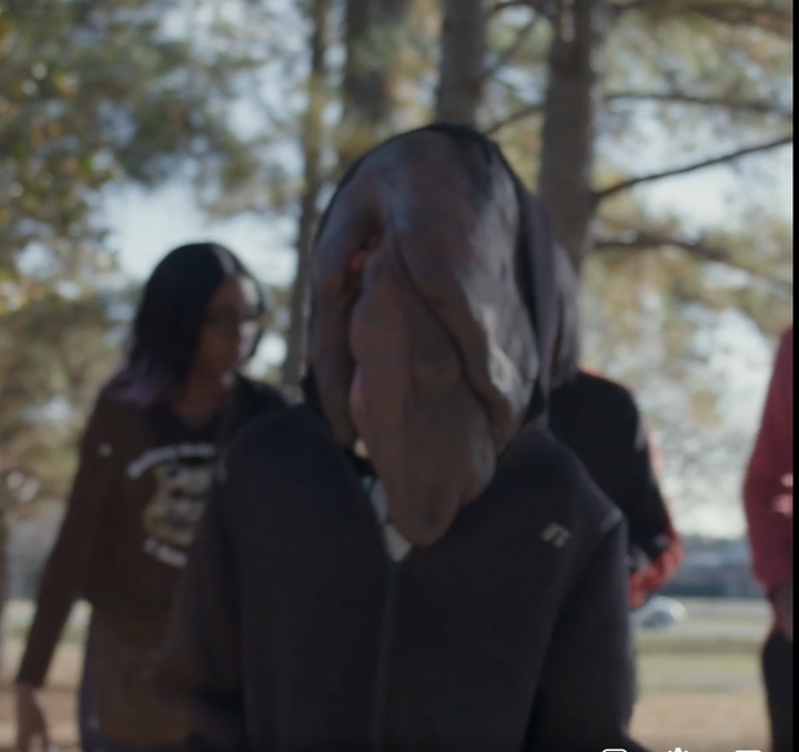 Xót xa hình ảnh hiện tại của cậu bé mang ‘gương mặt quỷ’ gây xôn xao 5 năm trước - 7