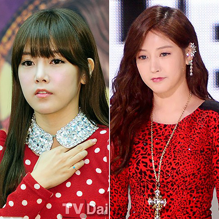 Mặt mũi biến dạng vì tai nạn, ca sĩ Hàn lột xác và có cái kết mỹ mãn sau 10 năm - 4