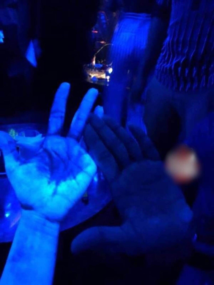 Đi tiệc, cô gái hoảng khi cơ thể bỗng phát sáng như zombie, lý do gây rùng mình - 5