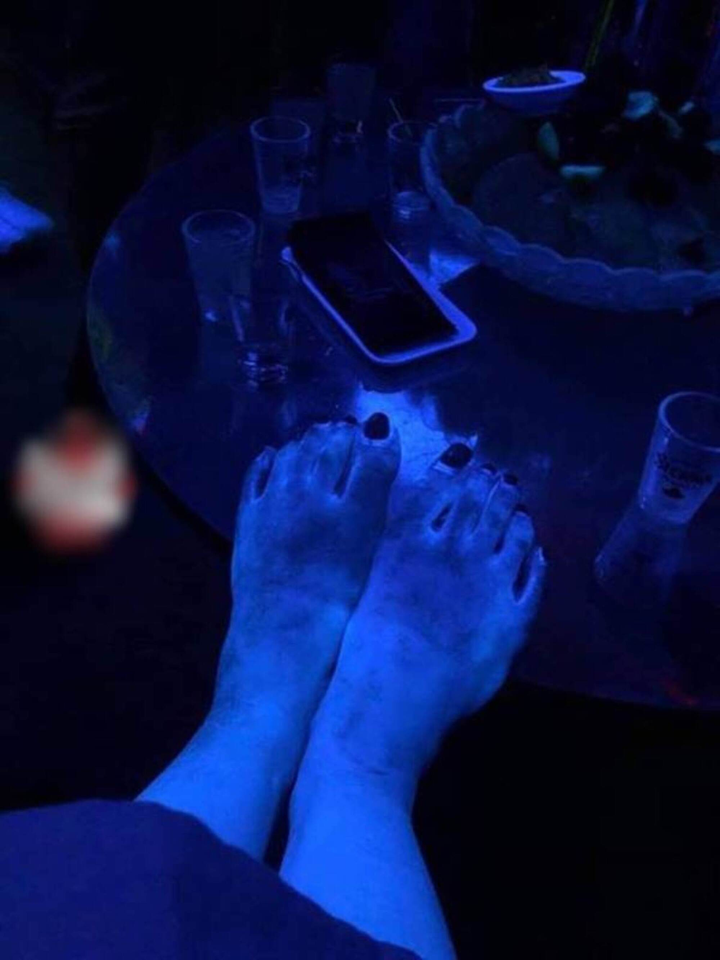 Đi tiệc, cô gái hoảng khi cơ thể bỗng phát sáng như zombie, lý do gây rùng mình - 6