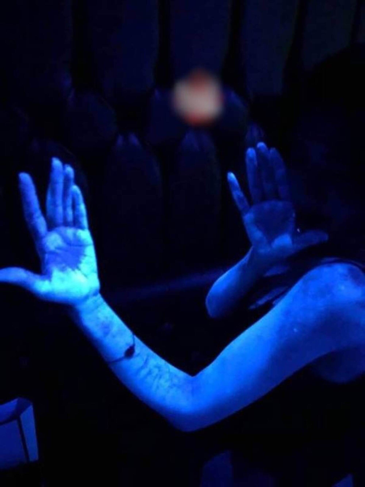 Đi tiệc, cô gái hoảng khi cơ thể bỗng phát sáng như zombie, lý do gây rùng mình - 2