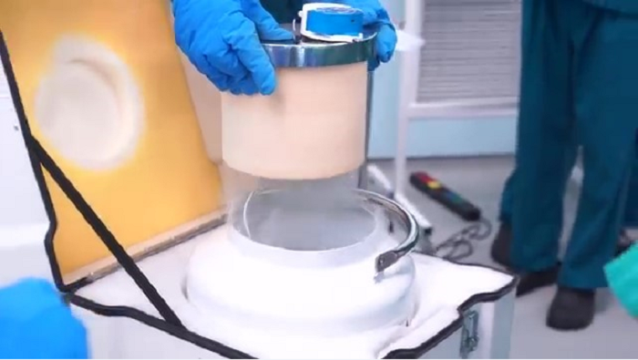 Vinmec ghép xương tự thân thành công cho bệnh nhân ung thư xương - 3