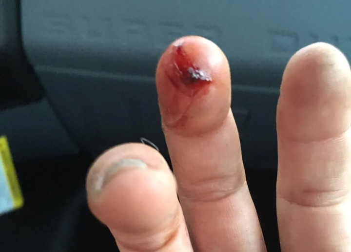 Mèo ‘giang hồ’ 1 mình cào nát mặt 7 con pitbull, ‘đánh’ luôn chủ chó nhập viện - 6