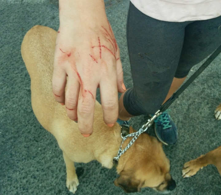 Mèo ‘giang hồ’ 1 mình cào nát mặt 7 con pitbull, ‘đánh’ luôn chủ chó nhập viện - 5