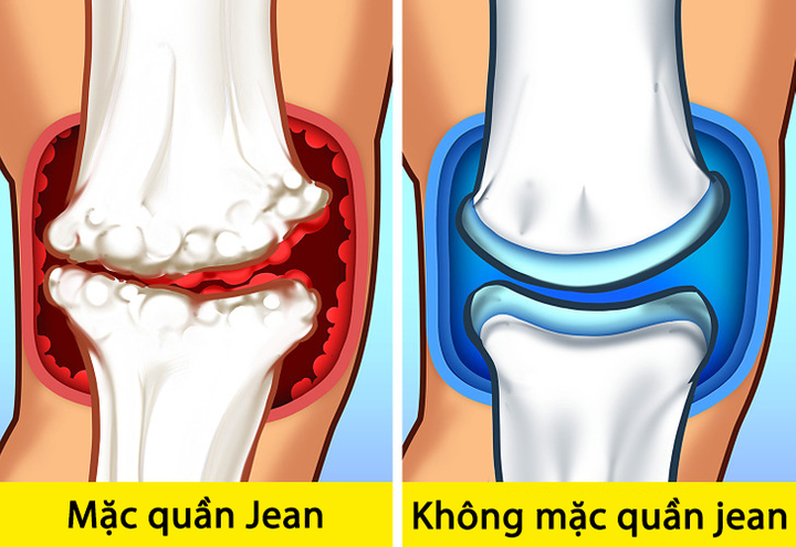 5 hậu quả tai hại khi mặc quần jean bó quá thường xuyên - 1