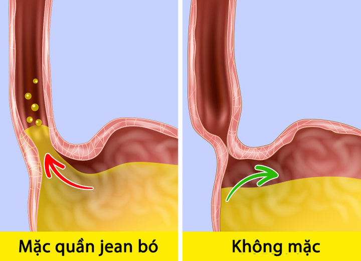 5 hậu quả tai hại khi mặc quần jean bó quá thường xuyên - 3