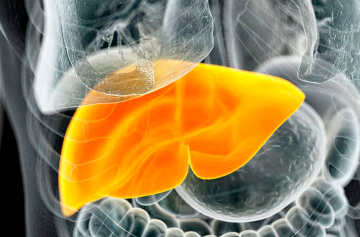 4 dấu hiệu bệnh xơ gan giai đoạn đầu: Phát hiện sớm có thể cứu sống người bệnh - 2