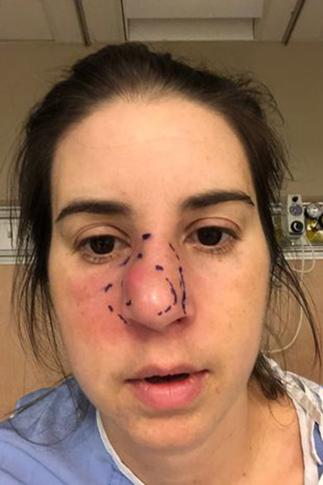 Cứ rửa mặt là đau, cô gái phải cắt toàn bộ mũi - 1