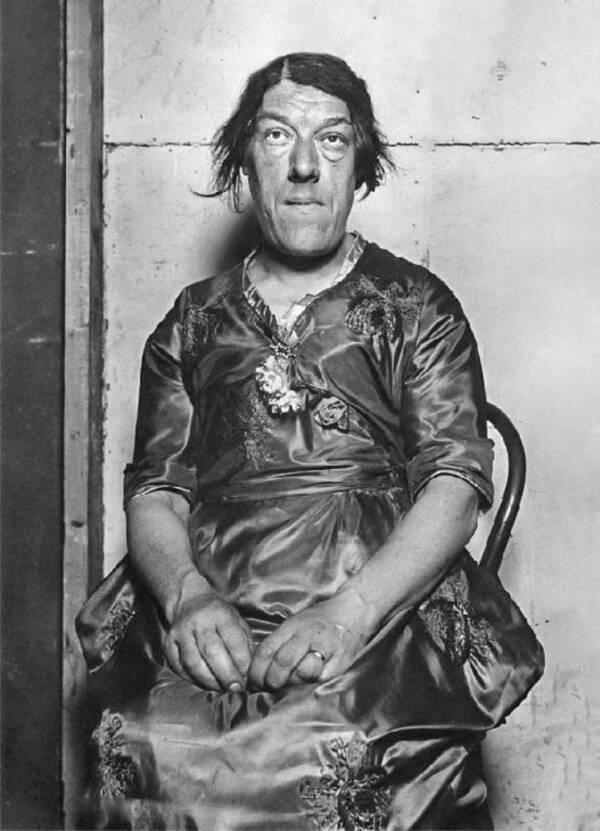 Cuộc đời bi thảm của 'người phụ nữ xấu nhất thế giới' - 4