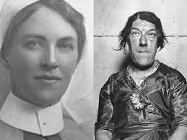 Cuộc đời bi thảm của 'người phụ nữ xấu nhất thế giới' - 2