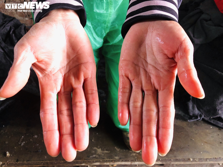 Người phụ nữ mỗi ngày bê 3 tấn đá lạnh, tay tê bì, đỏ ửng trong cái rét 8 độ C - 2