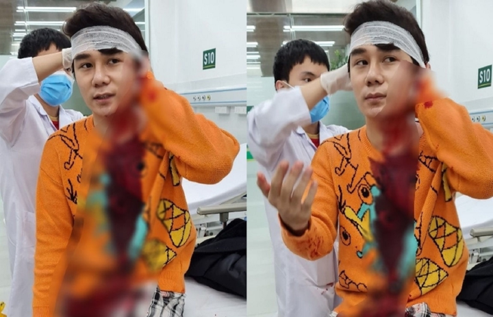 Nam diễn viên bị chém trọng thương đóng vai nào trong 'Thương ngày nắng về'? - 1