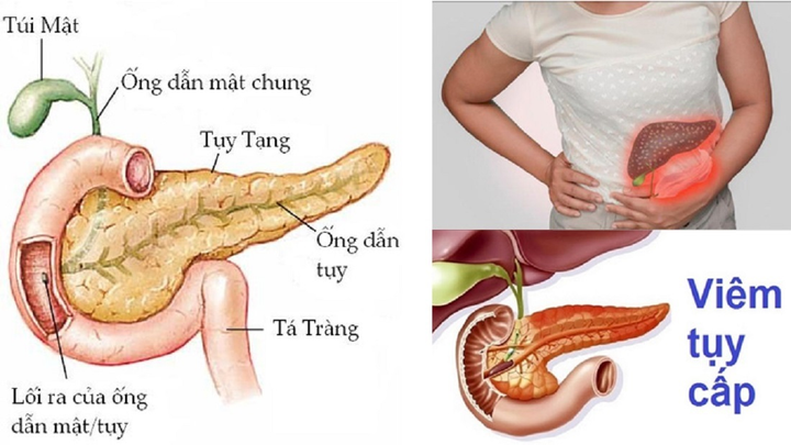 7 loại viêm nhiễm không nên coi thường vì dễ dẫn đến ung thư - 5