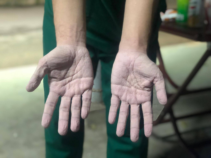 Nam điều dưỡng tuyến đầu chống dịch ám ảnh với câu hỏi: 'Bao giờ đến lượt tôi?’ - 3