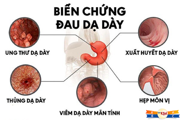 7 loại viêm nhiễm không nên coi thường vì dễ dẫn đến ung thư - 3