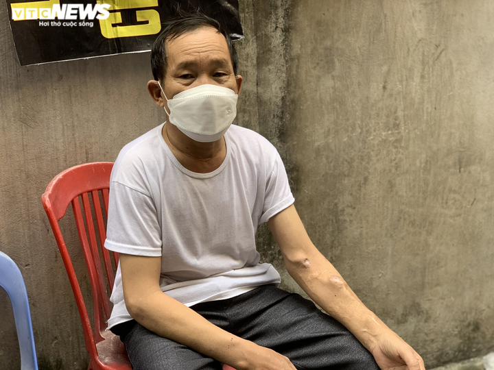 Thất nghiệp vì đại dịch, người dân xóm chạy thận nhịn cơm dành tiền mua thuốc - 1