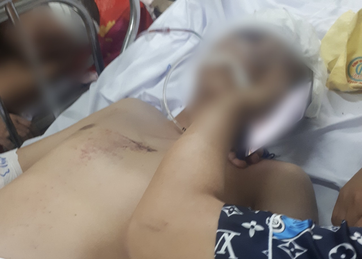 Bị tố truy đuổi, bỏ mặc người vi phạm bị tai nạn: Công an huyện ở Cà Mau nói gì? - 1